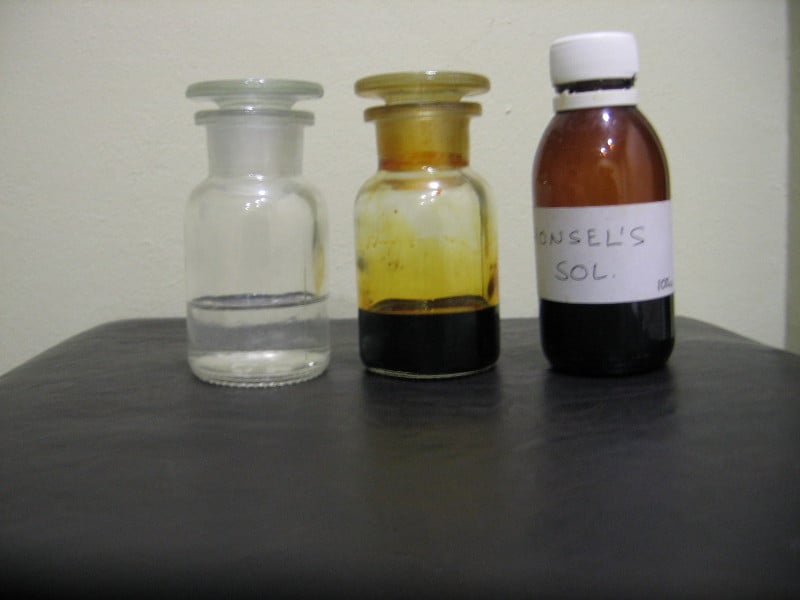 Διαλύματα οξικού οξέως, Lugol και Monsel